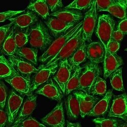 Cytokeratin 7 Antibody (KRT7/760 + KRT7/903), Novus Biologicals 0.1mg;