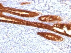 Cytokeratin 7 Antibody (KRT7/760 + KRT7/903), Novus Biologicals 0.1mg;