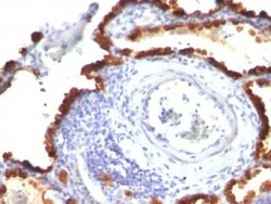 Cytokeratin 7 Antibody (KRT7/760 + KRT7/903), Novus Biologicals 0.1mg;