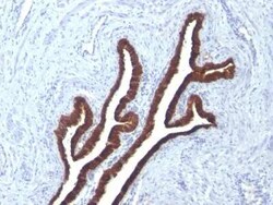 Cytokeratin 7 Antibody (KRT7/760 + KRT7/903), Novus Biologicals 0.1mg;