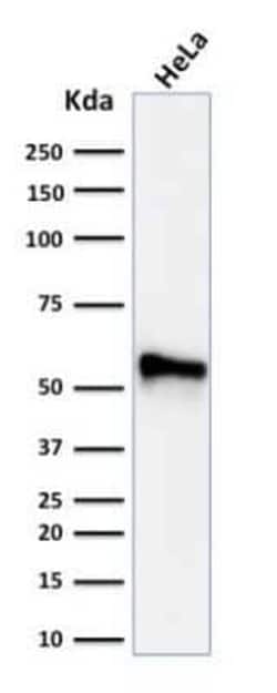 Cytokeratin 7 Antibody (KRT7/760 + KRT7/903), Novus Biologicals 0.1mg;