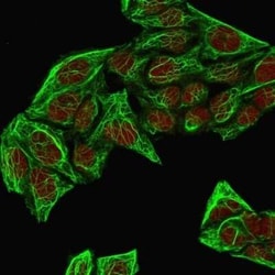 Cytokeratin 7 Antibody (KRT7/760 + OV-TL12/30), Novus Biologicals:Antibodies:Primary