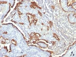 Cytokeratin 7 Antibody (KRT7/760 + OV-TL12/30), Novus Biologicals:Antibodies:Primary