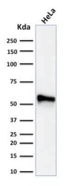 Cytokeratin 7 Antibody (KRT7/760 + OV-TL12/30), Novus Biologicals:Antibodies:Primary