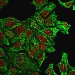 Cytokeratin 7 Antibody (KRT7/760), Novus Biologicals:Antibodies:Primary