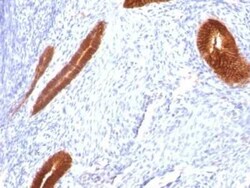 Cytokeratin 7 Antibody (KRT7/760), Novus Biologicals:Antibodies:Primary