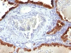 Cytokeratin 7 Antibody (KRT7/760), Novus Biologicals:Antibodies:Primary