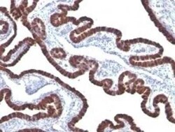 Cytokeratin 7 Antibody (KRT7/760), Novus Biologicals:Antibodies:Primary