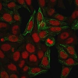 Cytokeratin 7 Antibody (KRT7/903), Novus Biologicals:Antibodies:Primary