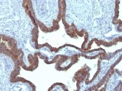 Cytokeratin 7 Antibody (KRT7/903), Novus Biologicals:Antibodies:Primary