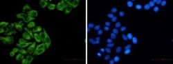 Cytokeratin 7 Antibody (S03-2E7), Novus Biologicals:Antibodies:Primary