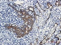 Cytokeratin 7 Antibody (S03-2E7), Novus Biologicals:Antibodies:Primary
