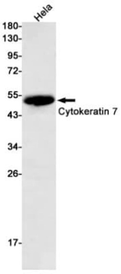 Cytokeratin 7 Antibody (S03-2E7), Novus Biologicals:Antibodies:Primary