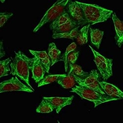 Cytokeratin 7 Antibody (SPM270), Novus Biologicals:Antibodies:Primary Antibodies