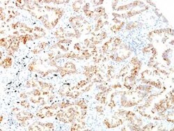 Cytokeratin 7 Antibody (SPM270), Novus Biologicals:Antibodies:Primary Antibodies