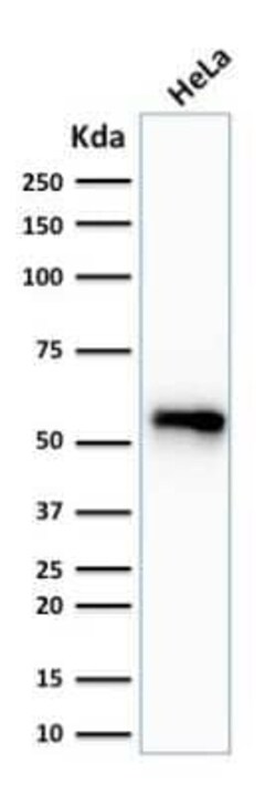 Cytokeratin 7 Antibody (SPM270), Novus Biologicals:Antibodies:Primary Antibodies
