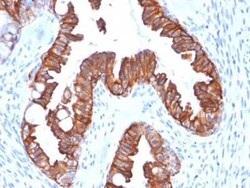 Cytokeratin 7 Antibody (rOV-TL12/30), Novus Biologicals 20&mu;g; Unlabeled:Antibodies,