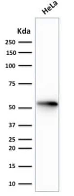 Cytokeratin 7 Antibody (rOV-TL12/30), Novus Biologicals 20&mu;g; Unlabeled:Antibodies,