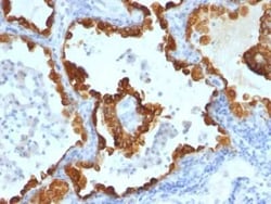 Cytokeratin 8/18 Antibody (C-43 + DC10), Novus Biologicals 0.02mg; Unlabeled:Antibodies,