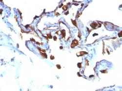 Cytokeratin 8/18 Antibody (C-51), Novus Biologicals:Antibodies:Primary