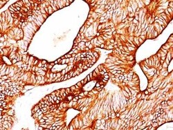 Cytokeratin 8/18 Antibody (KRT8/803 + KRT18/835), Novus Biologicals:Antibodies:Primary