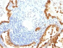 Cytokeratin 8/18 Antibody (KRT8/803 + KRT18/835), Novus Biologicals:Antibodies:Primary