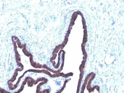 Cytokeratin 8/18 Antibody (KRT8/803 + KRT18/835), Novus Biologicals:Antibodies:Primary