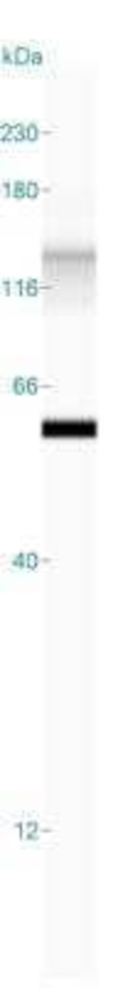 Cytokeratin 8/18 Antibody (KRT8/803 + KRT18/835), Novus Biologicals:Antibodies:Primary