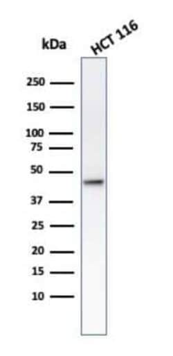 Cytokeratin 8 Antibody (B22.1), Novus Biologicals 0.1mg; Unlabeled:Antibodies,