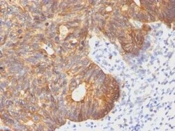 Cytokeratin 8 Antibody (C-43), Novus Biologicals:Antibodies:Primary Antibodies