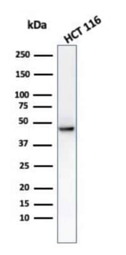 Cytokeratin 8 Antibody (C-43), Novus Biologicals:Antibodies:Primary Antibodies