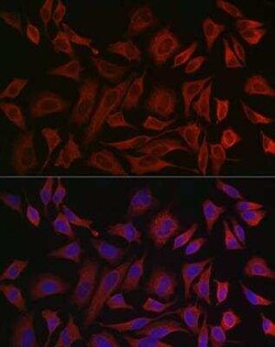 Cytokeratin 8 Antibody - Azide and BSA Free, Novus Biologicals 0.02 mL,