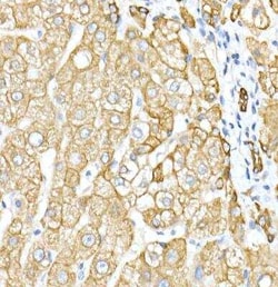 Cytokeratin 8 Antibody - Azide and BSA Free, Novus Biologicals 0.02 mL,