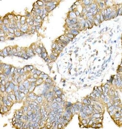 Cytokeratin 8 Antibody - Azide and BSA Free, Novus Biologicals 0.02 mL,