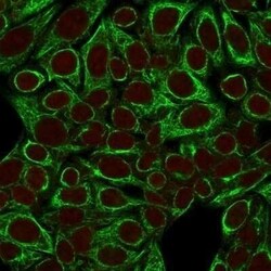 Cytokeratin 8 Antibody (SPM192) - Azide and BSA Free, Novus Biologicals 0.1 mg | Buy Online | Novus Biologicals | Fisher Scientific