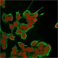 Cytokeratin 8 Antibody (SPM538) - Azide and BSA Free, Novus Biologicals 0.1 mg | Buy Online | Novus Biologicals | Fisher Scientific