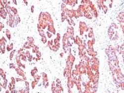 Cytokeratin, Basic (Type II or HMW) Antibody (SPM116), Novus Biologicals 0.02 mg | Buy Online | Novus Biologicals | Fisher Scientific