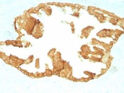 Cytokeratin, HMW Antibody (KRTH/1076), Novus Biologicals:Antibodies:Primary