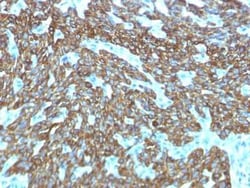 Cytokeratin, HMW Antibody (KRTH/1576R), Novus Biologicals:Antibodies:Primary