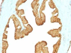 Cytokeratin, LMW Antibody (KRTL/1077), Novus Biologicals:Antibodies:Primary