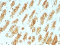Cytokeratin, LMW Antibody (KRTL/1077), Novus Biologicals:Antibodies:Primary