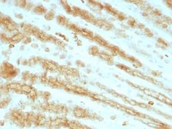 Cytokeratin, pan Antibody (KRTL/1077 + KRTH/1076), Novus Biologicals:Antibodies:Primary