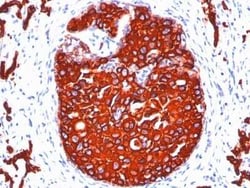 Cytokeratin, pan Antibody (KRTL/1077 + KRTH/1076), Novus Biologicals:Antibodies:Primary