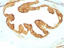 Cytokeratin, pan Antibody (KRTL/1077 + KRTH/1076), Novus Biologicals:Antibodies:Primary