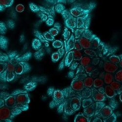 Cytokeratin, pan Antibody (PAN-CK (Cocktail)), Novus Biologicals:Antibodies:Primary