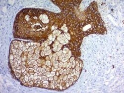 Cytokeratin, pan Antibody (PAN-CK (Cocktail)), Novus Biologicals:Antibodies:Primary