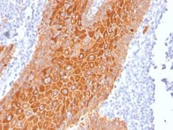 Cytokeratin, pan Antibody (PAN-CK (Cocktail)), Novus Biologicals:Antibodies:Primary