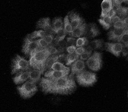 Cytokeratin, pan Antibody (PK110) - BSA Free, Novus Biologicals 0.025 mL,
