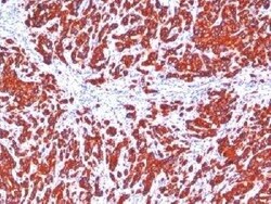 Cytokeratin, pan Antibody (SPM115 + SPM116) - Azide and BSA Free, Novus Biologicals 0.1 mg | Buy Online | Novus Biologicals | Fisher Scientific