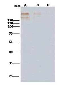 Cytomegalovirus gB Antibody (11B10D3E4), Novus Biologicals:Antikörper:Primärantikörper